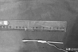 老人排尿困难，竟用棉棒自行“疏通”图片