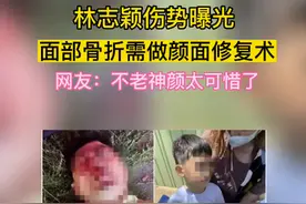 林志颖面容骨折要做颜面修复手术，躺街头挣扎，看起来很痛苦图片