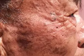 抗糖化=告别黄脸婆？图片