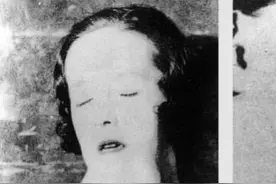 《1922年的牙疼：女孩的痛苦令人咂舌！》图片