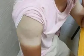 论云南的紫外线有多可怕？图片