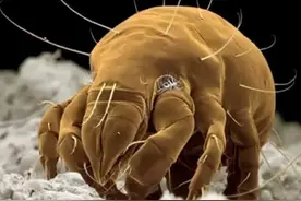 小孩身上若出现“这3个迹象”，或说明床上螨虫“成窝”，别忽略图片