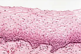 派特灵生物科普｜子宫颈低级别鳞状上皮内病变管理的中国专家共识图片