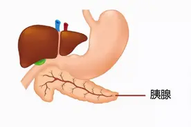 提醒大家：若酒后出现5个症状，或与“胰腺炎”有关，别不当回事图片