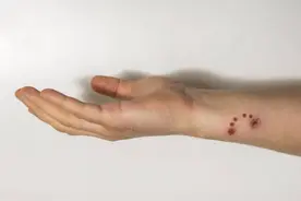 9岁男童狂犬病发作离世，临终前注射了疫苗，为何人还是没了？图片