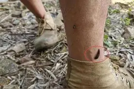 如果水蛭被人误入到体内，它是否会对人的身体造成危害呢？图片