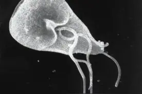 食脑虫进入人体有两种途径，提醒：别在不干净的水中游泳图片