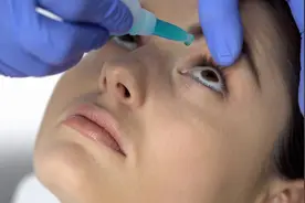 干燥综合征是什么原因引起的呢？图片
