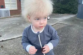 美国1岁萌娃患罕见病，竟意外走红！网友融化：他太可爱了图片