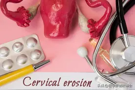 宫颈癌：从确诊到死亡仅仅6个月！五个症状，可能是子宫在求救图片