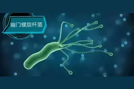 感染率高达65%的幽门螺杆菌，跟以下6种情况有极大的关系图片