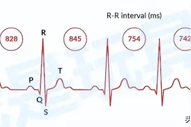 浅谈：佳明、博能、高驰运动表 HRV 功能的区别图片