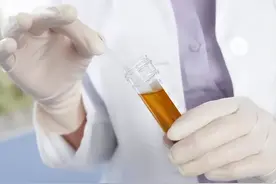 尿液很黄，究竟是身体缺水，还是生病了？有这7种可能性图片