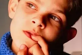 从小“咬指甲”的孩子，长大后怎样了？医生：一般逃不掉5种结局图片