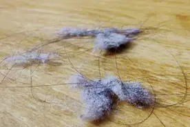 家里天天打扫，还会有很多“毛絮”，为啥直到现在仍没有解决方法图片