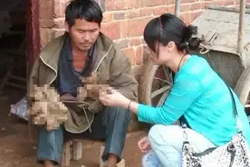 故事：湖南男子身患怪病，手脚长树枝还能开花，专家检查发现真相图片