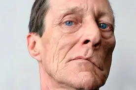 一张方子8味药，健脾养胃、祛风化痰，半个月治愈面瘫，巧化解图片