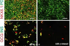 治疗糖尿病细胞 │ 澳大最新胰腺研究获广泛关注图片