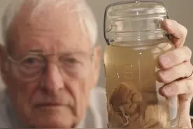 被人偷走切成了240块，爱因斯坦的大脑隐藏了什么秘密？图片