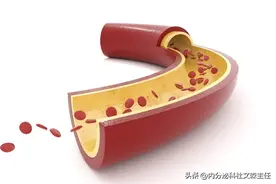 不管你的结节几级，别轻易切！我的方法说给你！图片