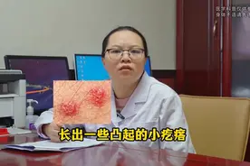 下体长出小疙瘩，别拖别抠，抓紧去治图片