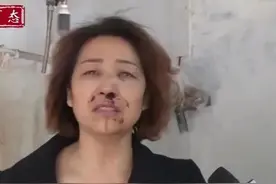 女子抱孙子没洗手，竟被儿子打成脑震荡……图片