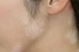 这样用护肤品，不仅浪费钱，可能还会烂脸！看完别再踩雷图片