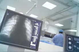 X线和CT及核磁共振的区别，你知道吗？看完一点不懵了图片