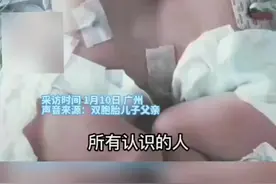 父母为省钱未做四维生下连体双胞胎图片