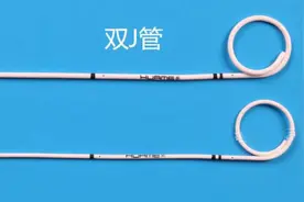 泌尿外科的“利器”——双J管图片
