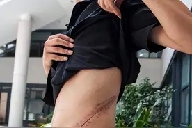 11年前，那个卖肾换“iPhone 4”的17岁小伙，如今怎样了？图片