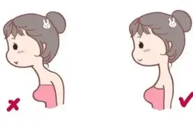 案例丨弯腰驼背体态差，体态矫正训练你尝试了吗？图片