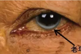 新发现：有这12种长相的老人，千万要当心了！赶紧自查图片