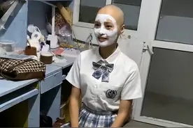 女大学生频繁掉发索性剃成光头，当事人：想试下能不能改善发质，同学都觉得挺有勇气图片