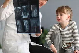 脊椎侧弯怎么办？脊椎侧弯必须要开刀？图片