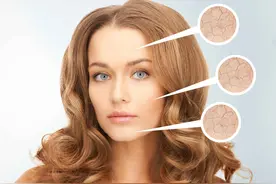 为何夏天皮肤依然干燥发痒？早知道早预防图片