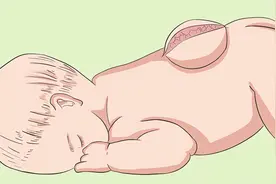 脊柱裂来临前，会先经历3个症状！劝告：一旦出现，别轻易忽视了图片