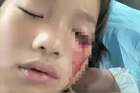 后续！江苏8岁女童眼睛被男孩打瞎：有免罪金牌不立案，内幕透露图片