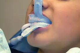 “娃太小不配合，涂氟会白涂？”12个涂氟疑问，来了！图片