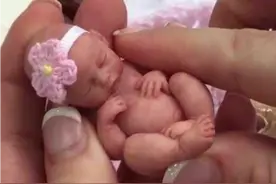 美国“拇指姑娘”：出生时仅25厘米，重280克，后来活下来了吗？图片