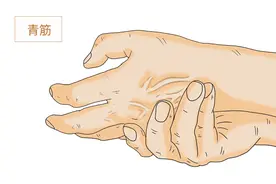 有人手臂“青筋暴起”是怎么回事？和“青筋看不见”比谁更健康？图片