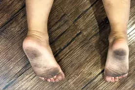 孩子不爱穿鞋，真正的坏处只有一个图片