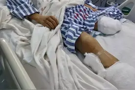 病人截肢手术后的断肢，最后都去哪儿了？答案或在你意料之外图片