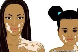 脖子后面有白斑现在越来越多了怎么办图片