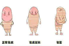 包皮过长要不要手术 包皮手术多大年龄可以做 儿童包皮手术图片