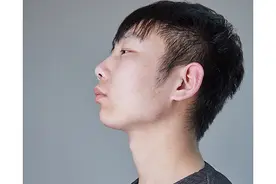 脖子上长的“小肉粒”究竟是啥？抠掉会咋样？如何处理？图片