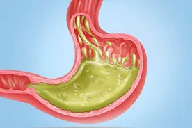 95元的奥美拉唑和5元的奥美拉唑，到底有何区别？医生说出实情图片