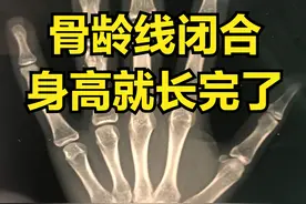肯定地说！孩子骨骺线一旦闭合，身高就长完了，肯定不能再长了图片