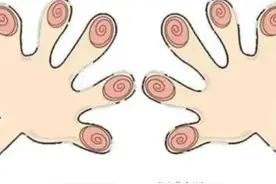 手指上的“斗”和“簸箕”，是与基因有关，命运天注定？图片