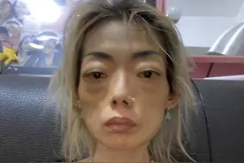 她嫁入豪门，为丈夫暴瘦至44斤，外形犹如骷髅图片